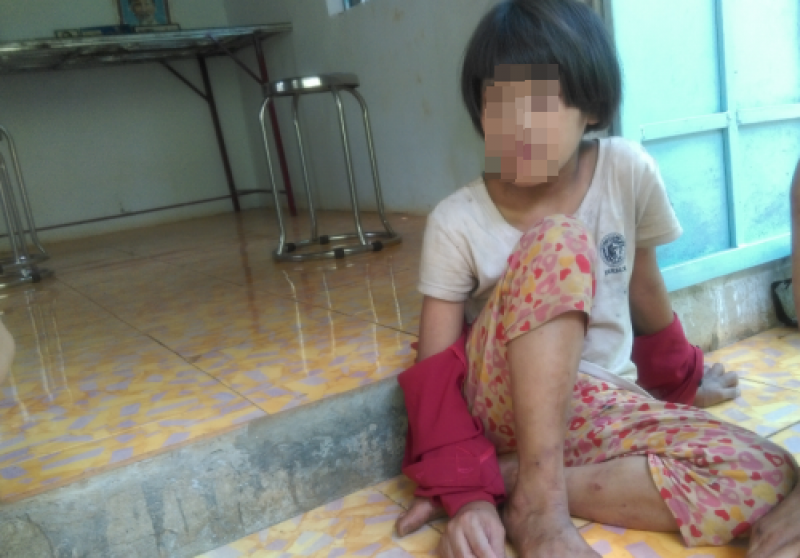 Toà tuyên phạt bà Mỳ 24 tháng tù giam Xét xử sơ thẩm vụ mẹ cắt gân con ở Bình Phước: